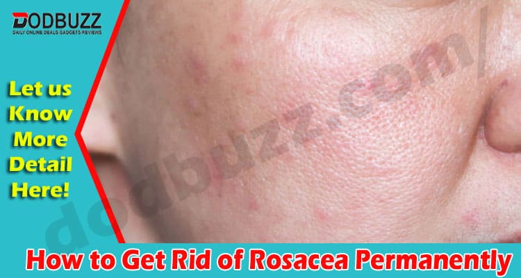 Complete Information How to Get Rid of Rosacea Permanently