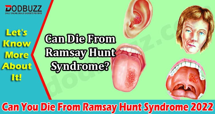 Latest News Can You Die From Ramsay Hunt Syndrome
